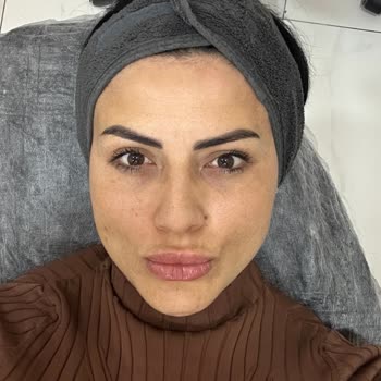 Hugua Estetik & Güzellik Yanık ve Leke Artışı Yaratan Estetik İşlem İçin 7.000 Tl İadesi Talebi