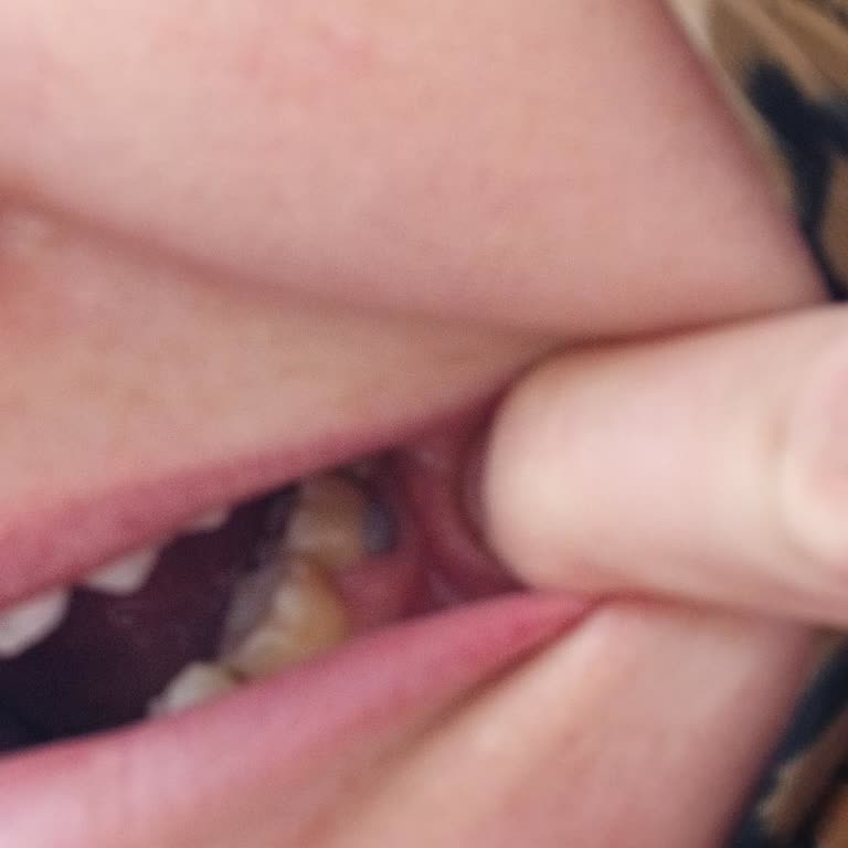 Diş Hekimi Uzmanın Sert Tutumu Ve Yetersiz Anesteziyle Ağrılı İşleme Zorlaması