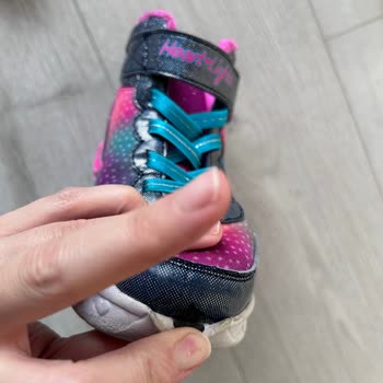 Skechers Çocuk Botunda Açılma Ve Işık Arızası, Garanti İade Talebi