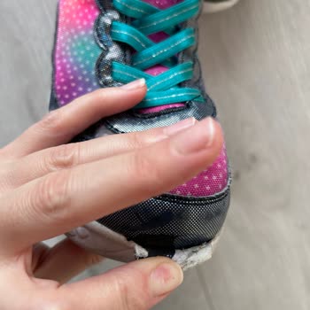 Skechers Çocuk Botunda Açılma Ve Işık Arızası, Garanti İade Talebi