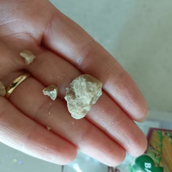 Reis Gıda Baldo Pirinç Paketinin İçinde Yabancı Cisimler