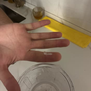 Philips 5000 Blenderde Plastik Parça Kırılması Ve Gıdaya Karışması Sağlık Riski