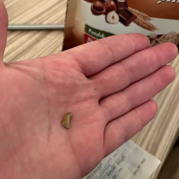 Burch Müsli İçinde Taş Bulunması Sağlık Riski Yaratıyor