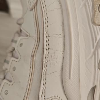 Skechers Ayakkabısında Üç Ayda Çatlama Ve Kullanıcı Hatası Kararına İtiraz