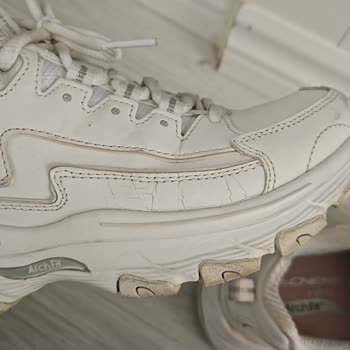 Skechers Ayakkabısında Üç Ayda Çatlama Ve Kullanıcı Hatası Kararına İtiraz