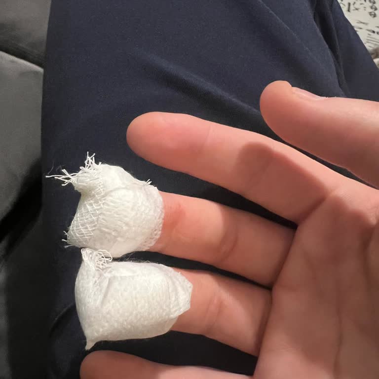 Keskin Rende Şiddetli Kesiklere Neden Oldu, IKEA’dan Ücretsiz Değişim İstiyorum