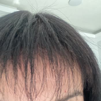 Mustafa Kayapınar Hair Artist Mağduriyeti