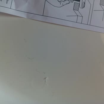 Kirli Ve Kullanılmış Klozet Kapağı Gönderildi