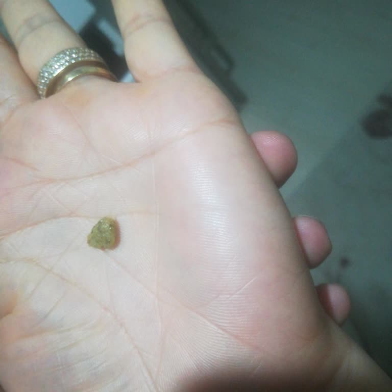 Cips İçinde Sert Yabancı Parça Boğazıma Neredeyse Kaçtı