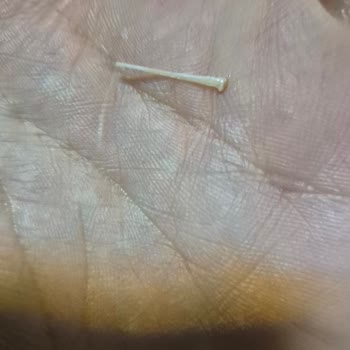 Ton Balığı Konservelerinde Kılçık Çıktı, Boğaza Takıldı