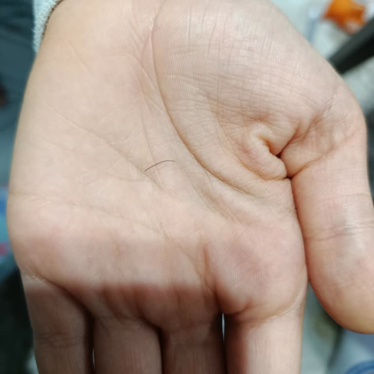 Kıl Çıkan Köri Soslu Noodle Üründe Hijyen Ve Sağlık Endişesi