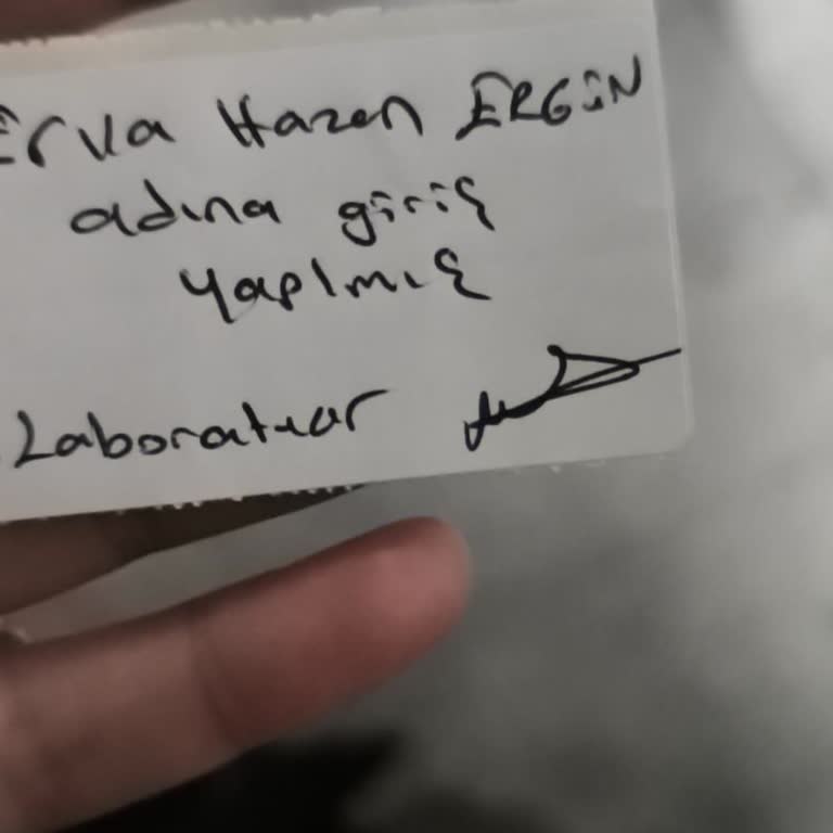 Yeni Doğan Bebeğin Tahlilinde Barkod Hatası