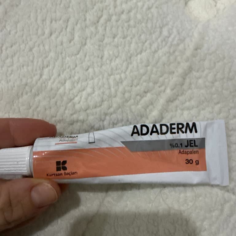 Reçeteli Adaderm Jel Kullanımında Şiddetli Akne Ve Kalıcı Cilt Hasarı