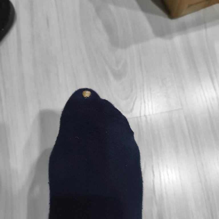 Sağ Tek Ayakta Keskin Kenar Çorapları Deldi, Hatalı Botun Değiştirilmesini İstiyorum