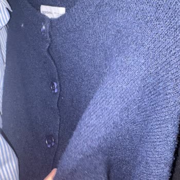 Bershka Cekette Hızlı Tüylenme Ve Kalite Sorunu