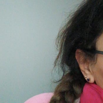 Sea Color Saç Boyasında Ani Siyahlaşma Ve Kaşıntı; A101 Şubesinde Kaba Tutum