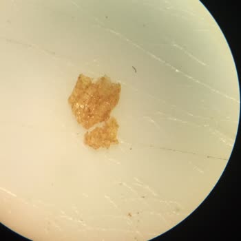 Kahve Dünyası Türk Kahvelerinde Plastik Yabancı Cisimler Resmi İnceleme Talebi