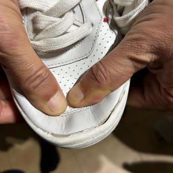 Ayakkabının Derisinde Çatlamalar Ve Trendyol’da Çözüm Bulunamaması