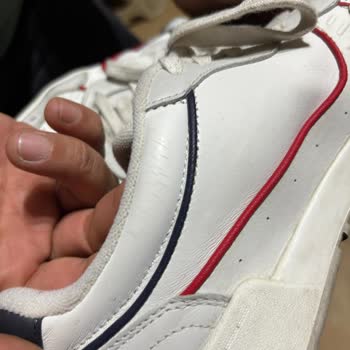 Ayakkabının Derisinde Çatlamalar Ve Trendyol’da Çözüm Bulunamaması