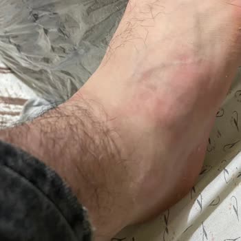 Bursa Yüksek İhtisas Hastanesi Travma Bölümünde İlgisiz Ve Yanıltıcı Tedavi