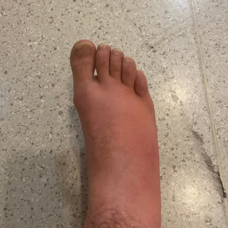 Bursa Yüksek İhtisas Hastanesi Travma Bölümünde İlgisiz Ve Yanıltıcı Tedavi