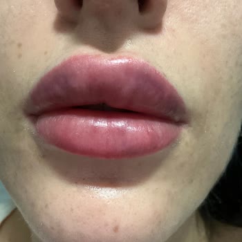 Dr. Slava Klinik Verdiğim Para Çöp Oldu