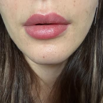 Dr. Slava Klinik Verdiğim Para Çöp Oldu