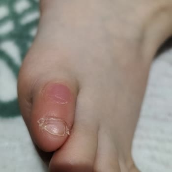 Kız Çocuğunun Biker Botunda Yara Oluştu Ve Mağaza İadeyi Reddetti