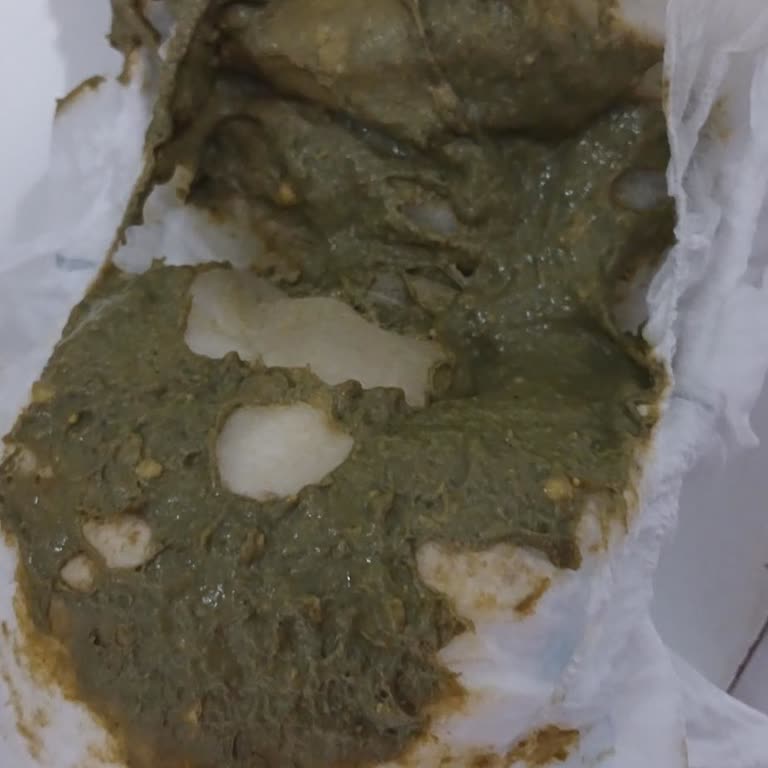 Hipp Organik Mama Kullanımından Bebekte Uyku Ve Tuvalet Bozuklukları, İade Talebi