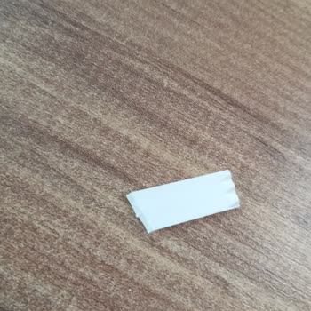 Seç-Al Küflü Fıstık Ve Plastikli Jelibon, Şube Müdürünün Saygısız Davranışı