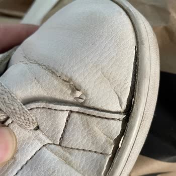 Adidas Ayakkabım Erken Yıprandı, Kullanıcı Hatası Söylenerek Sorun Çözülmedi