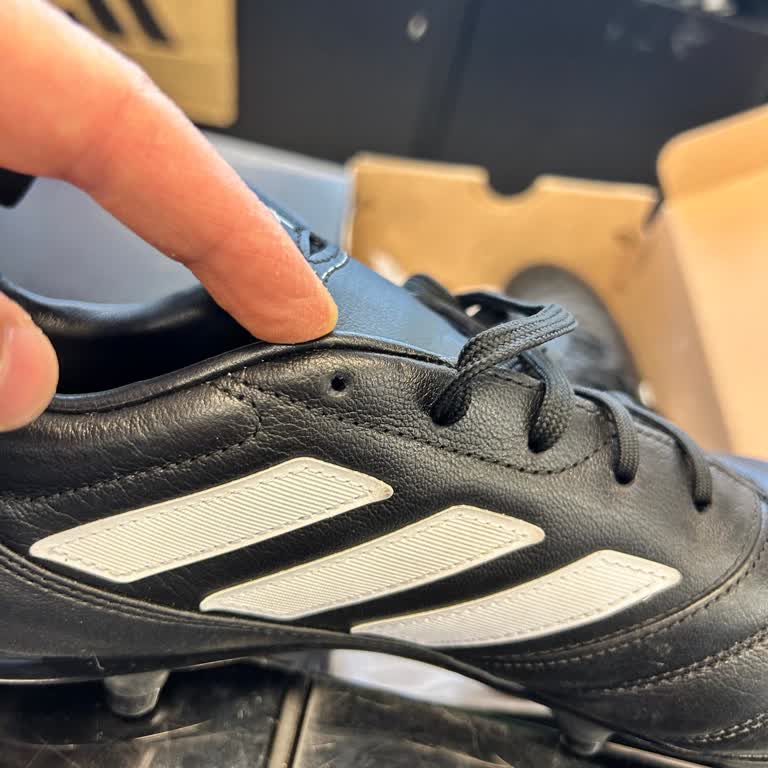 Adidas Bileğime Yara Açan Krampon Ve Şirketin Kullanıcı Hatası Açıklaması