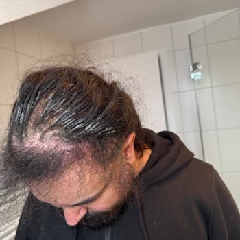 Rönesans Peruka Orijinal Özbek Saçı İddiası Yanıltıcı, Keratin Kalitesi Saçlarımı Kırdı