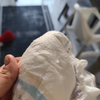 Molfix Bebek Bezinde Tavuk Tüyü Çocuk Sağlığına Tehdit Oluşturuyor