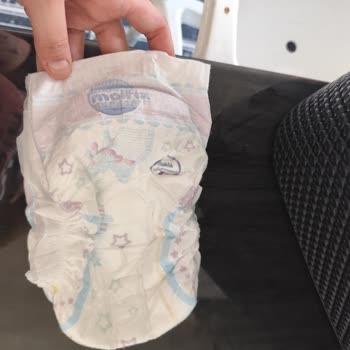 Molfix Bebek Bezinde Tavuk Tüyü Çocuk Sağlığına Tehdit Oluşturuyor