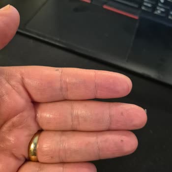 Neutrogena Yoğun Nemlendirici Kremi Ciltte Soyulma Ve Kir Birikimi Yarattı