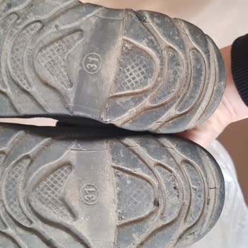 Ayakkabı Alt Tabanı Üç Ayda Açıldı, Mağaza Üretim Hatasını Reddediyor