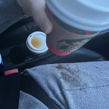 Starbucks Bardak Kapağı Patlayınca Sıcak Kahve Dökülüp Bacağıma Yanık Verdi