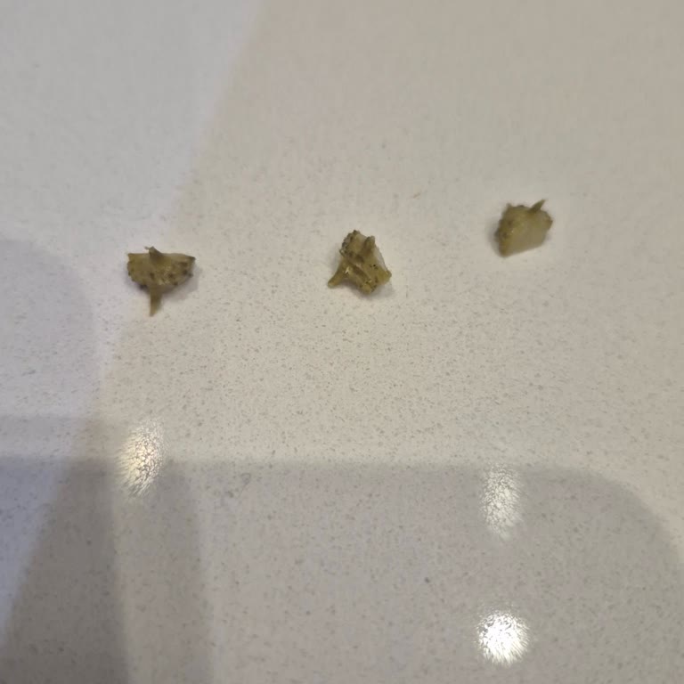 Süper Fresh Dondurulmuş Fasulyede Dikenli Yabancı Madde Bulundu