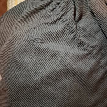 Beymen Ceketi Kullanım Sonrası İplerinin Çözülmesi Ve Haksız Kullanıcı Hatası İddiası