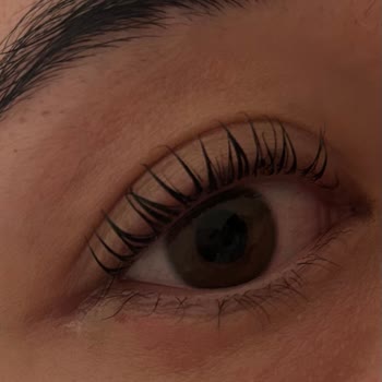 Göz Altı Bandı Olmadan Kirpik Lifting Sonrası Tahriş Ve İade Talebi