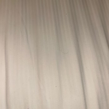 Hilton Garden Inn Erzincan’da Hijyen Çöküşü Ve Aşırı Ücret