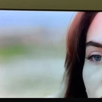 Renk Yanması Sorunu Yaşadığım LG OLED TV İçin Ücretsiz Onarım Talebi