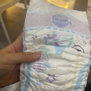 Molfix Bebek Bezlerinde Sürekli Sızdırma Ve Kalite Düşüşü Şikayeti