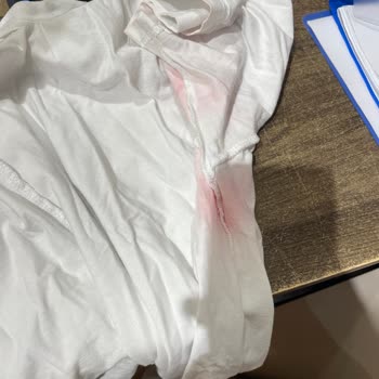 Ayıplı Mont İçin Değişim Hakkı Engellendi Ve Fiyat Farkı Talep Ediliyor