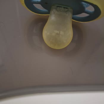 Kısa Sürede Sararmış Philips Avent Ultra Air Emzik Ucu: Değişim Talebi