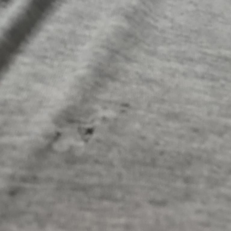 Penti Pijama Setinde Fare Tahribatı Ve Delik: Hijyen Ve Güven Sorunu