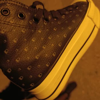 Sert İç Tabanlı Ayakkabı Ayaklarımda Şiddetli Ağrı Ve Şişlik Yarattı