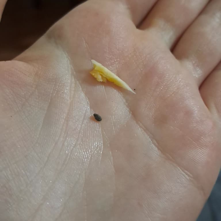 BİM'den Satın Aldığım Rus Salatasında Taş Ve Sert Yabancı Madde