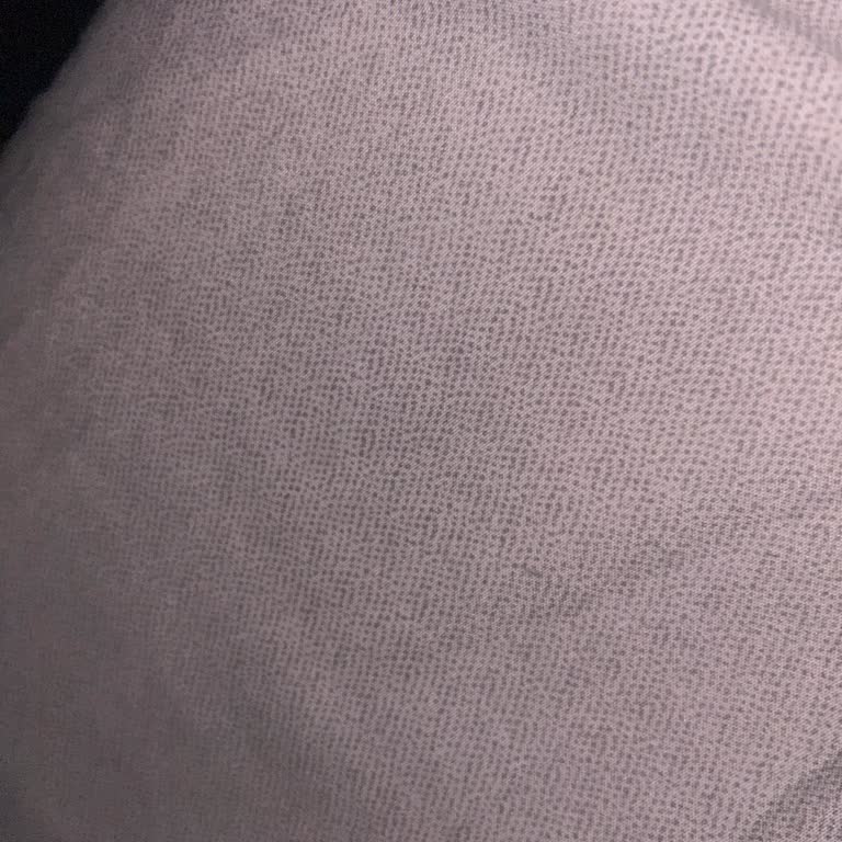 Madame Coco Nevresim Takımında Hızlı Tiftiklenme Ve Kabarma Şikâyeti